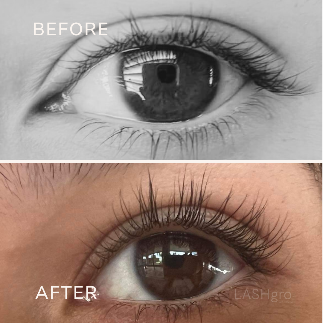 Best results for lash serum