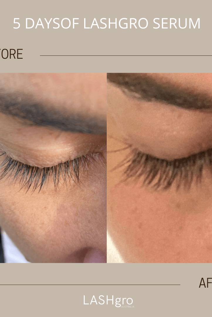 Lash Serum before and after results