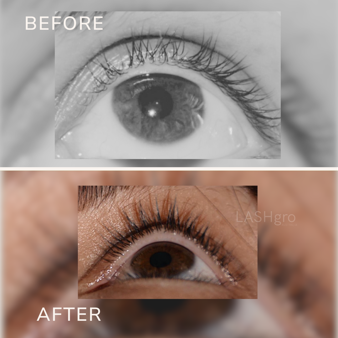 Before and After Lashgro Results