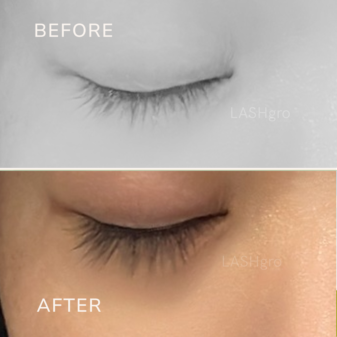 Eyelash Growth Lashgro Australia