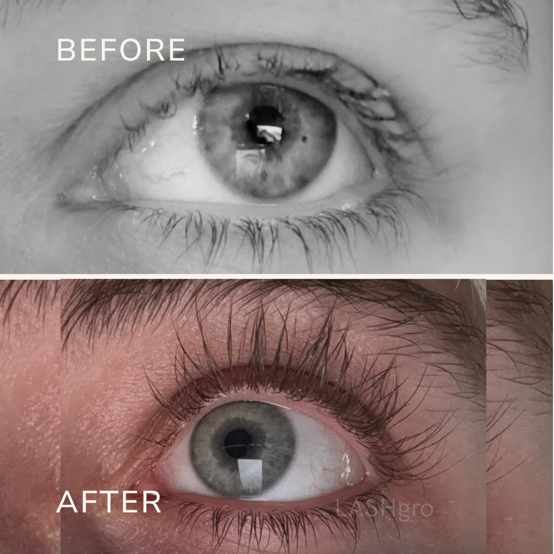 Before and After with Lash Serum