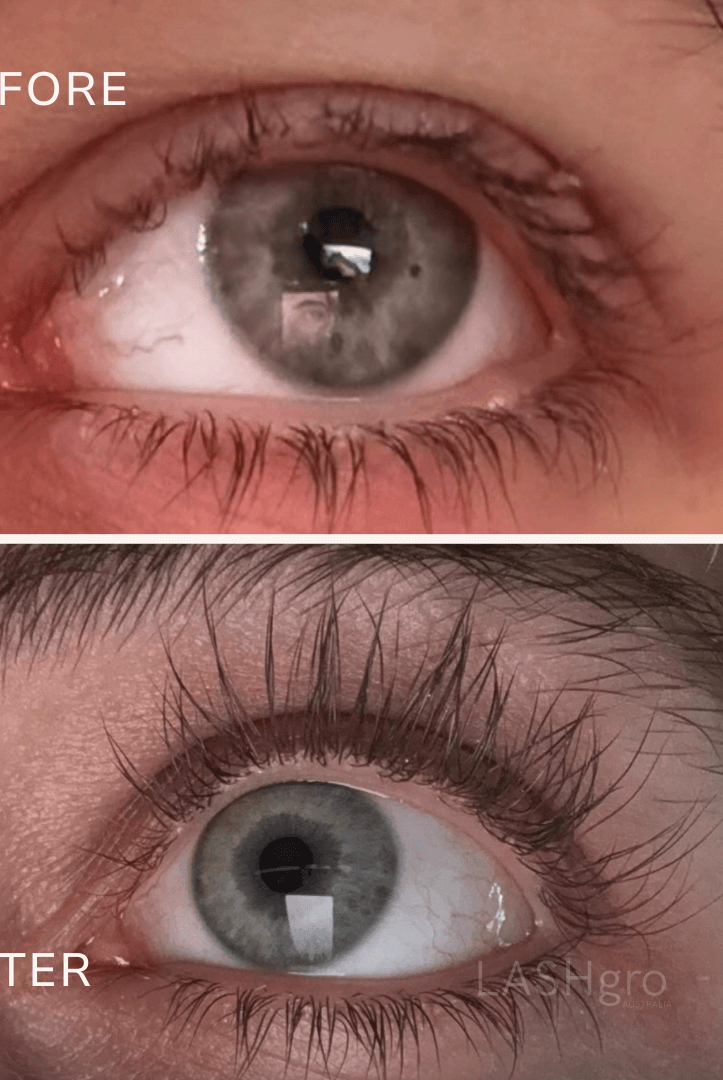 Eyelash Growth Serum Results Lashgro Australia