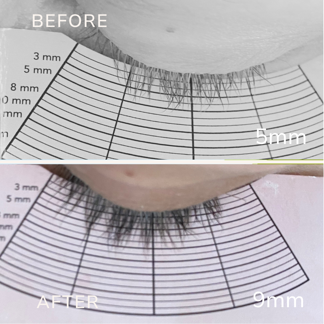 Results Eyelash growth