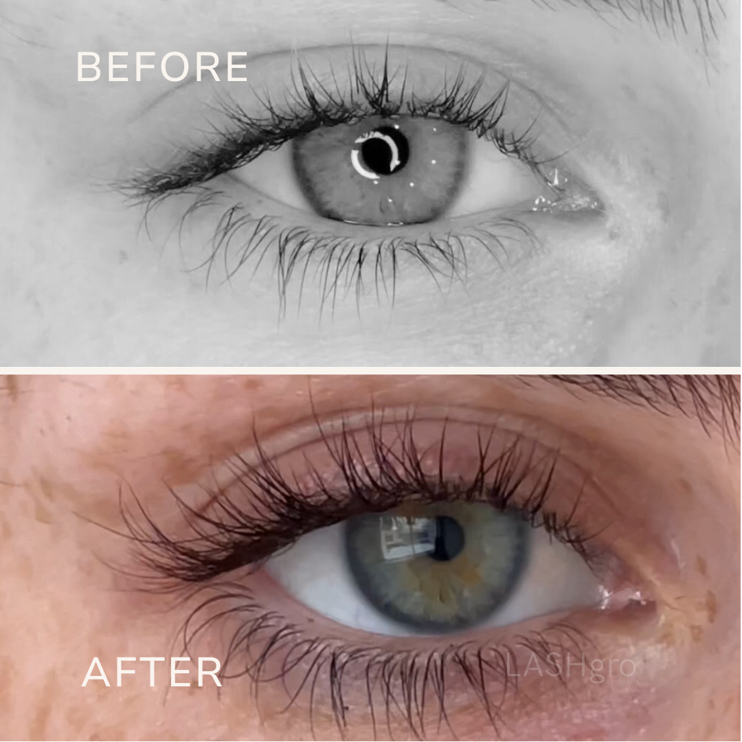 Lash Serum Results