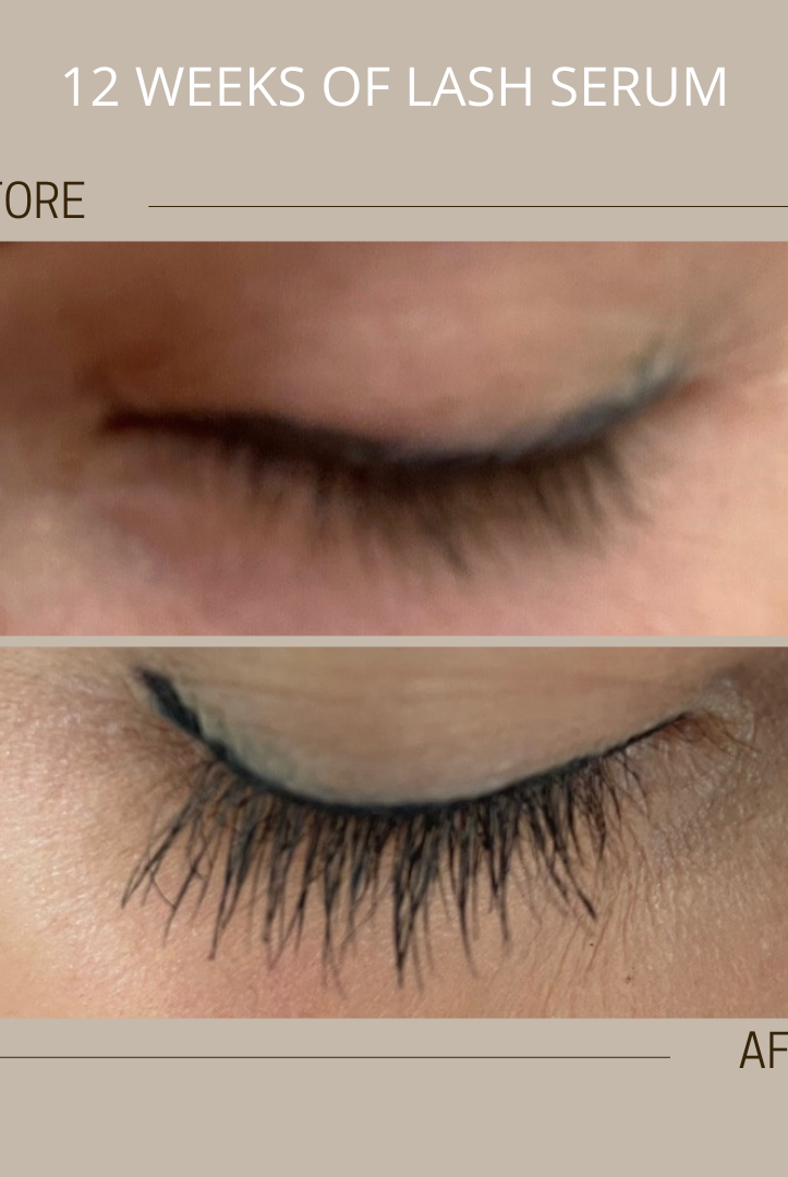amazing lash serum results