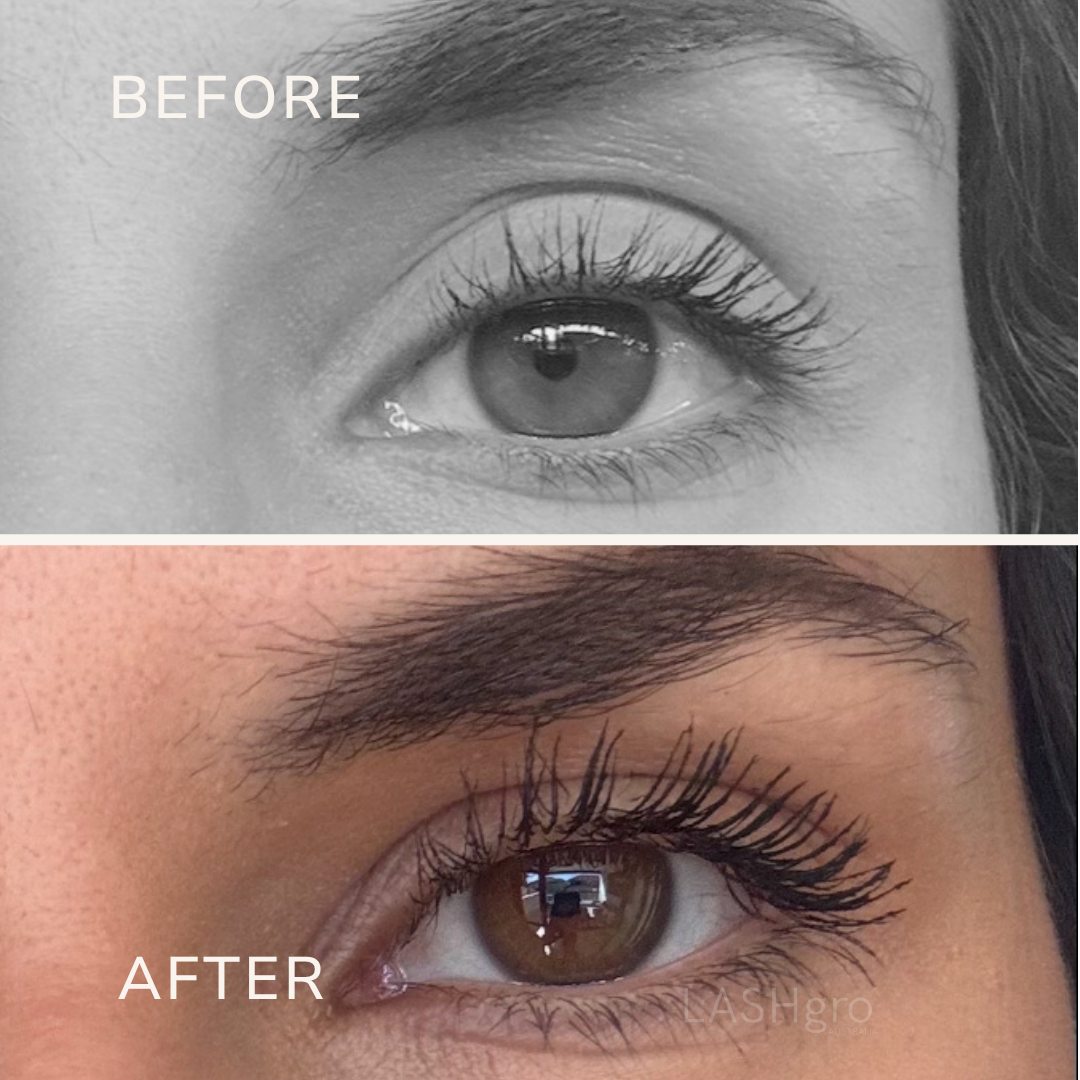 Results with Lashgro Lash Serum