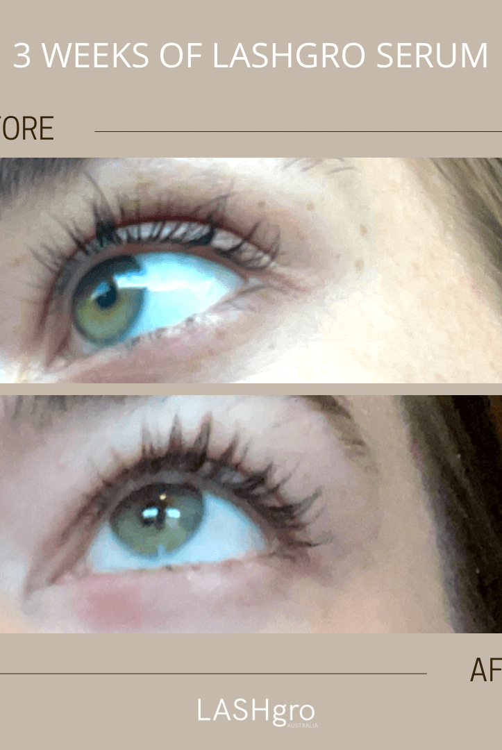 lash serum results australia