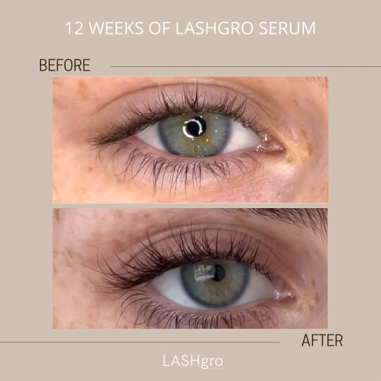 Best Eyelash Growth Serum Australia