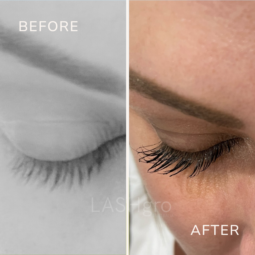 Lash Serum before and after