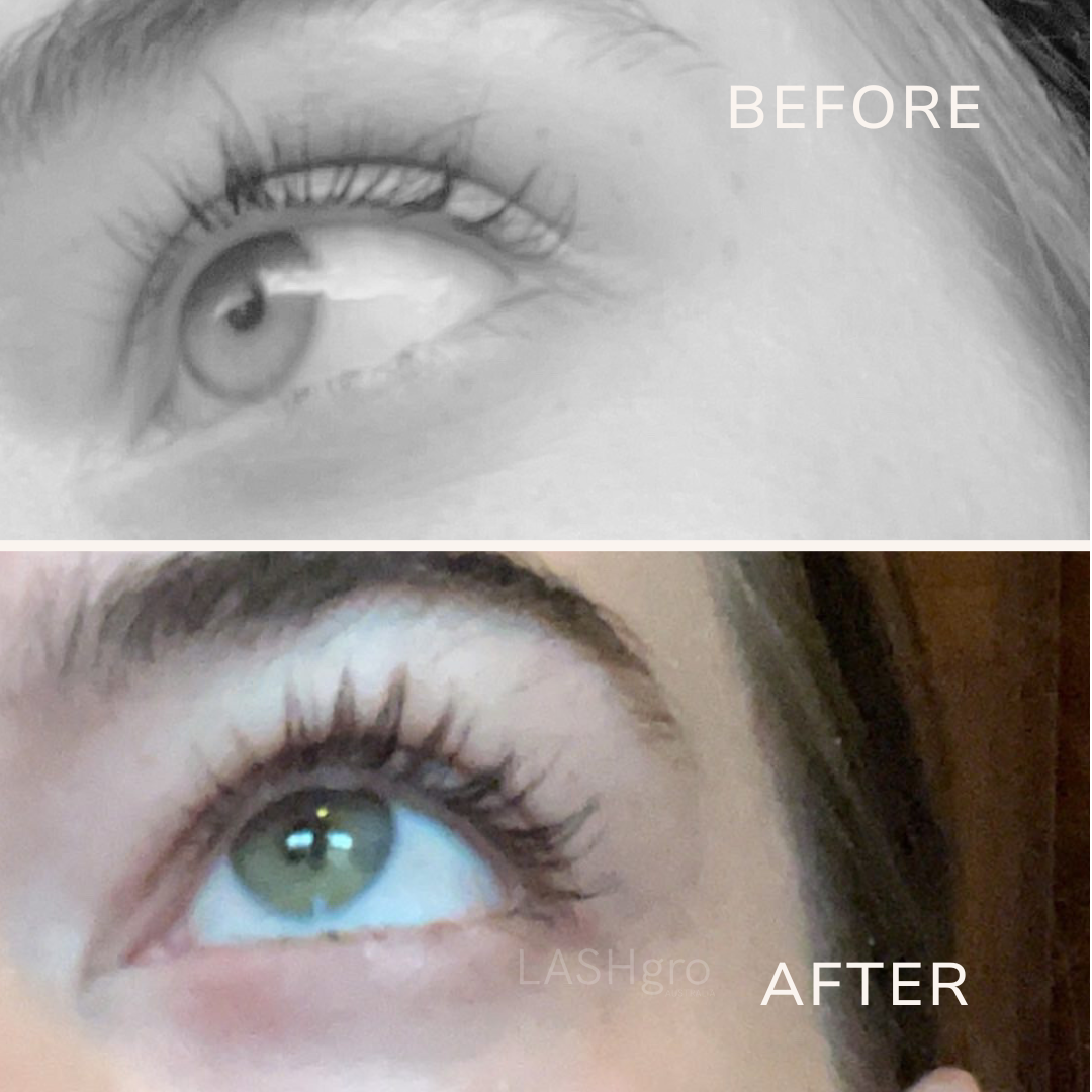 Amazing eyelash growth