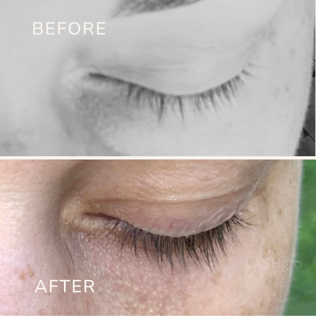 Best Lash Serum Results Australia