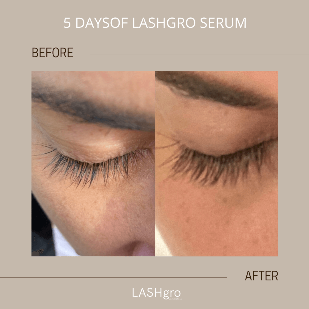 Lash Serum before and after results