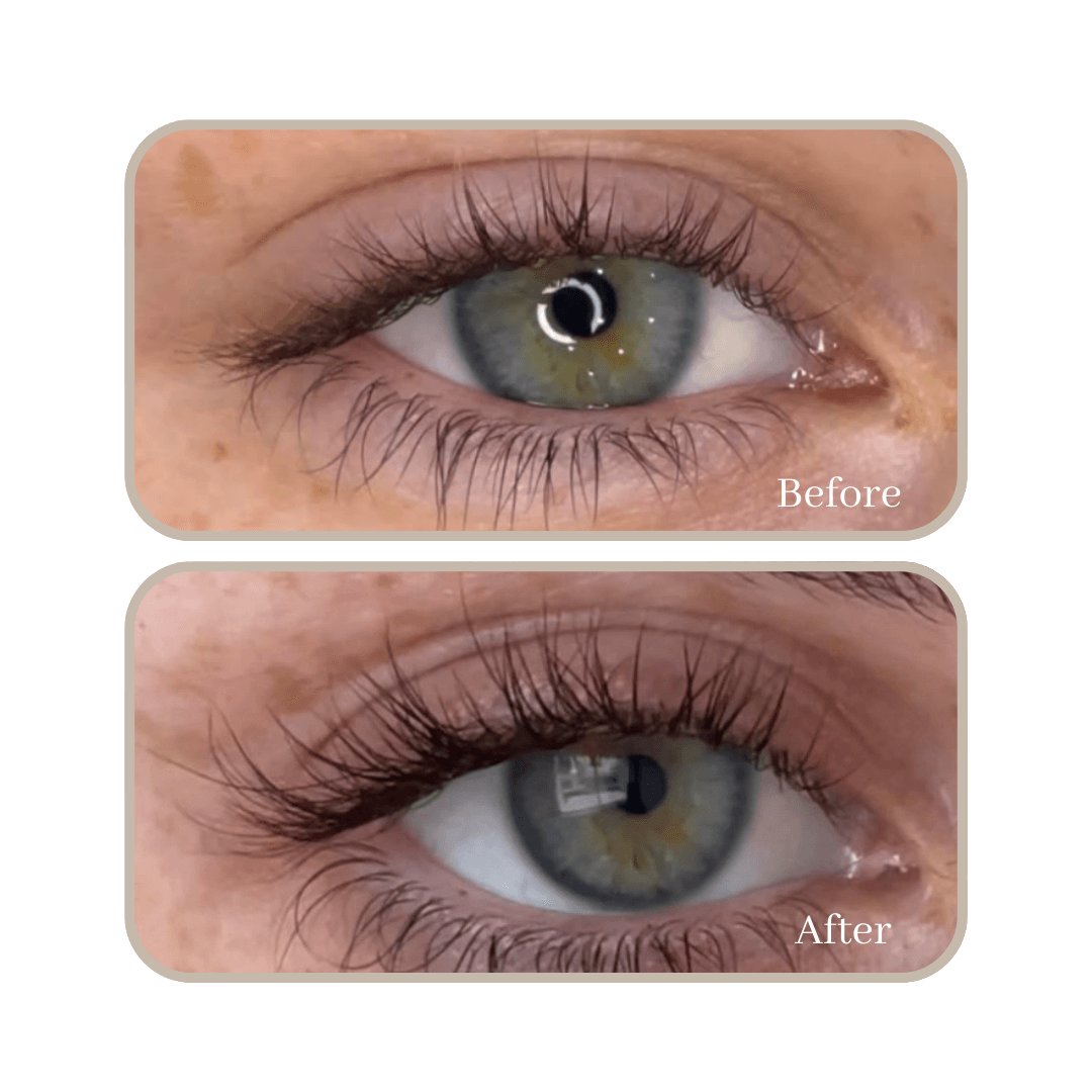 12 week lash serum results