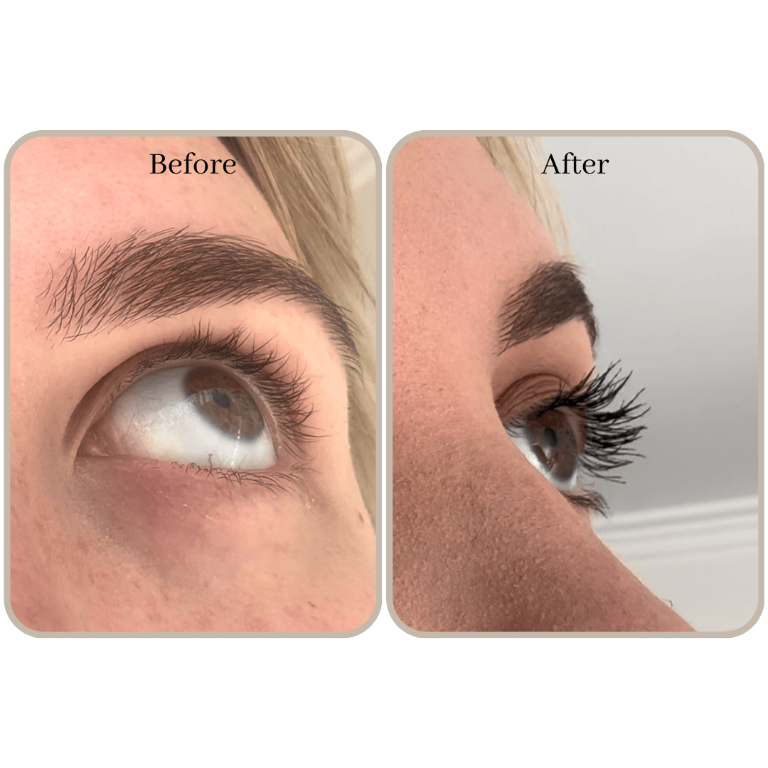 Best lash serum results australia