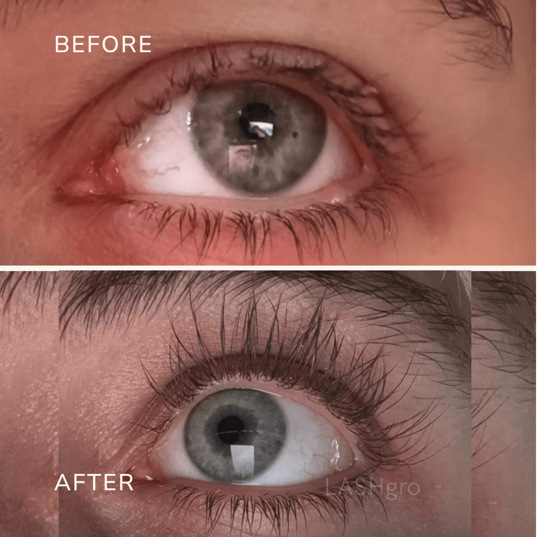 Eyelash Growth Serum Results Lashgro Australia