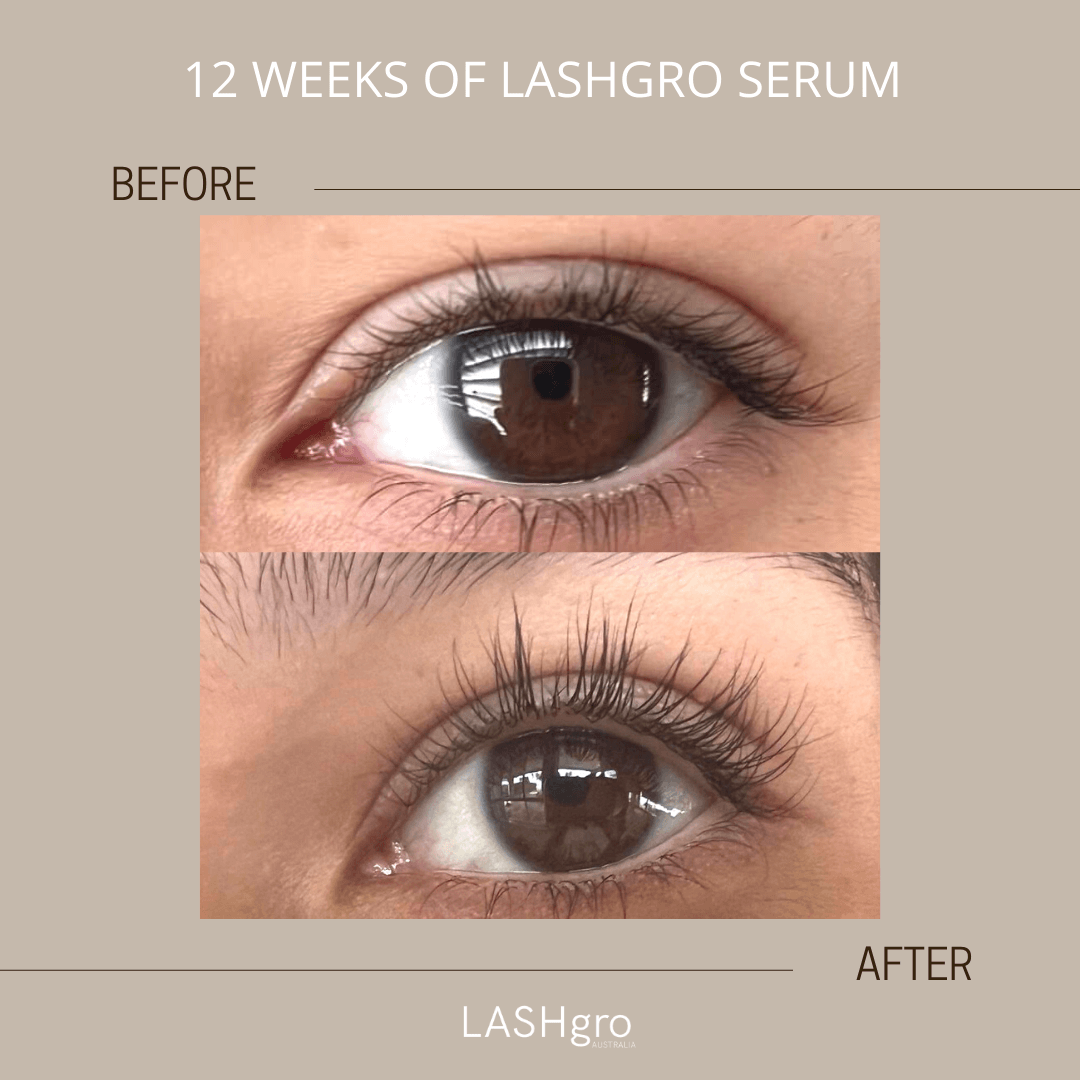 eyelash serum results