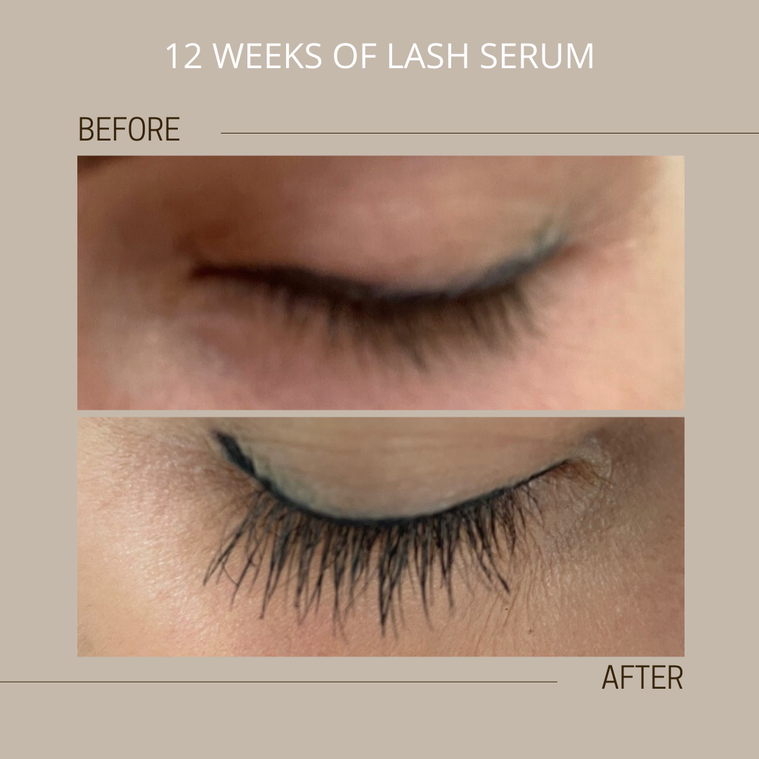 amazing lash serum results