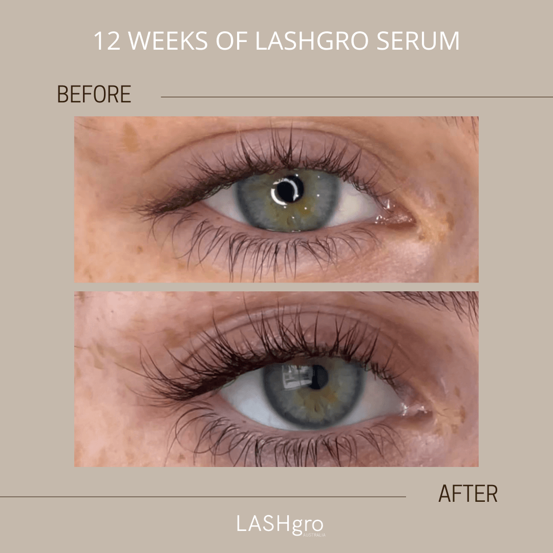 lash growth serum results