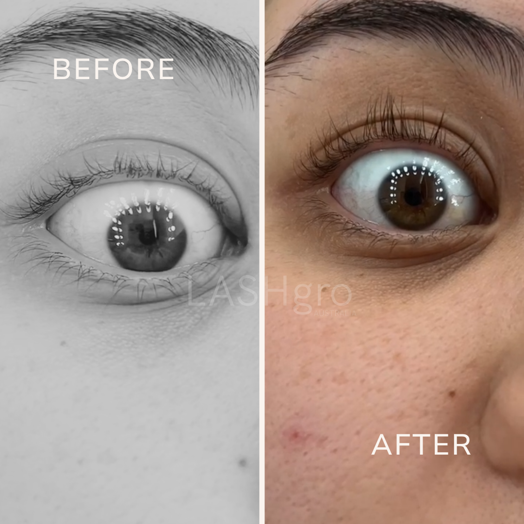 Before and After Eyelash Serum