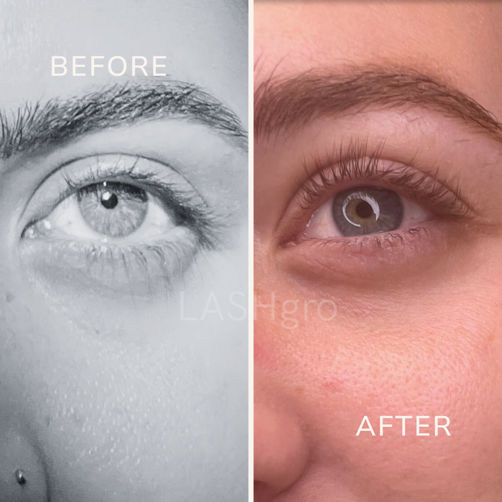 Eyelash growth Results
