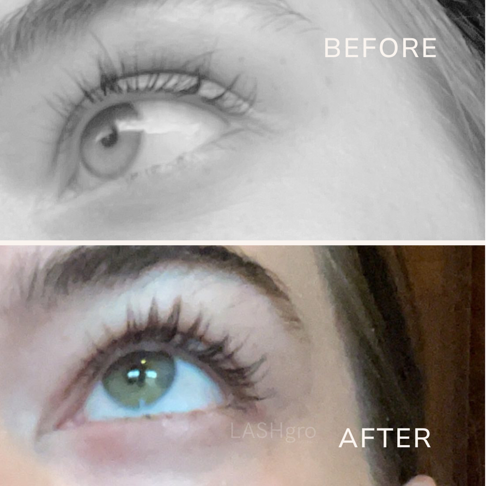 Amazing eyelash growth