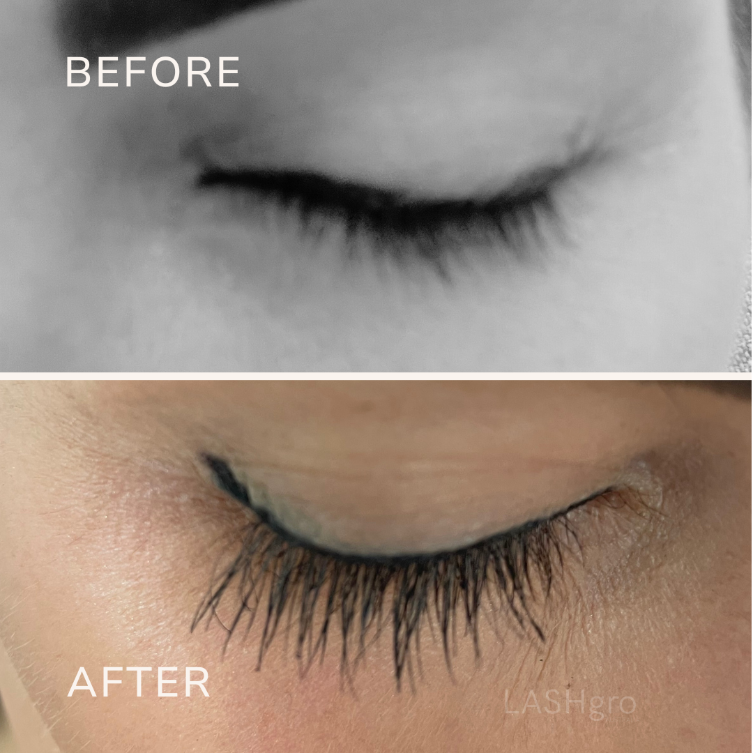 Lash Growth Australia 