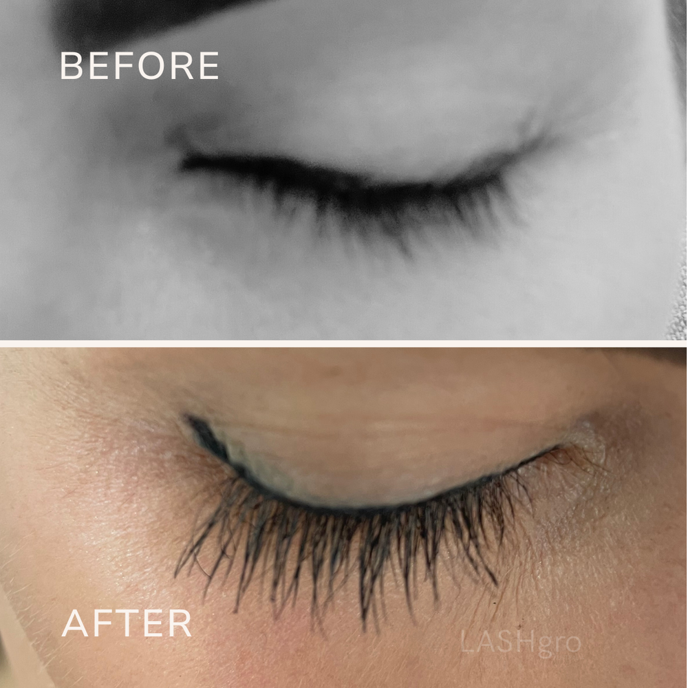 Lash Growth Australia 