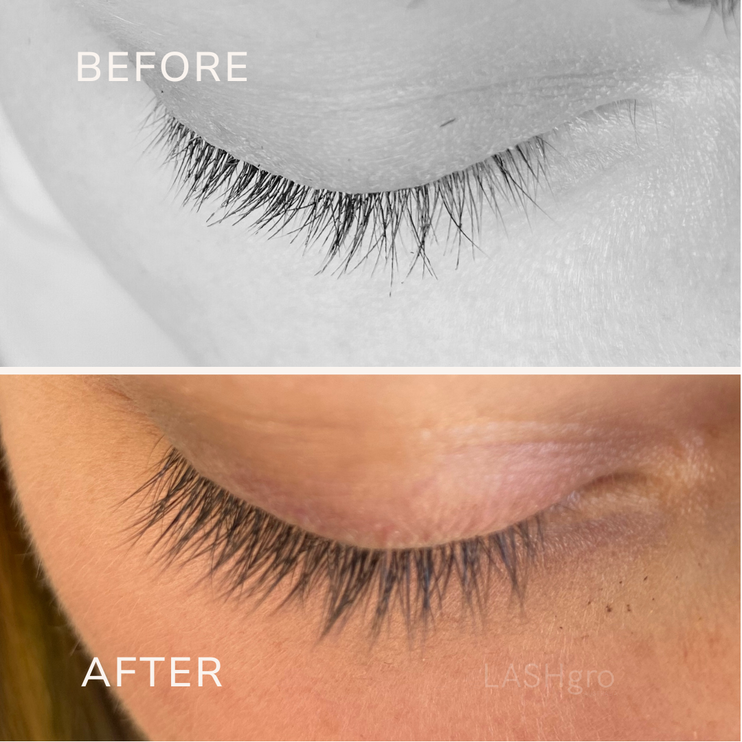 Growth from Triple Peptide Lash Serum