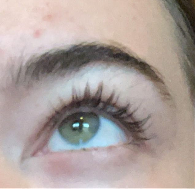 after results lashgro