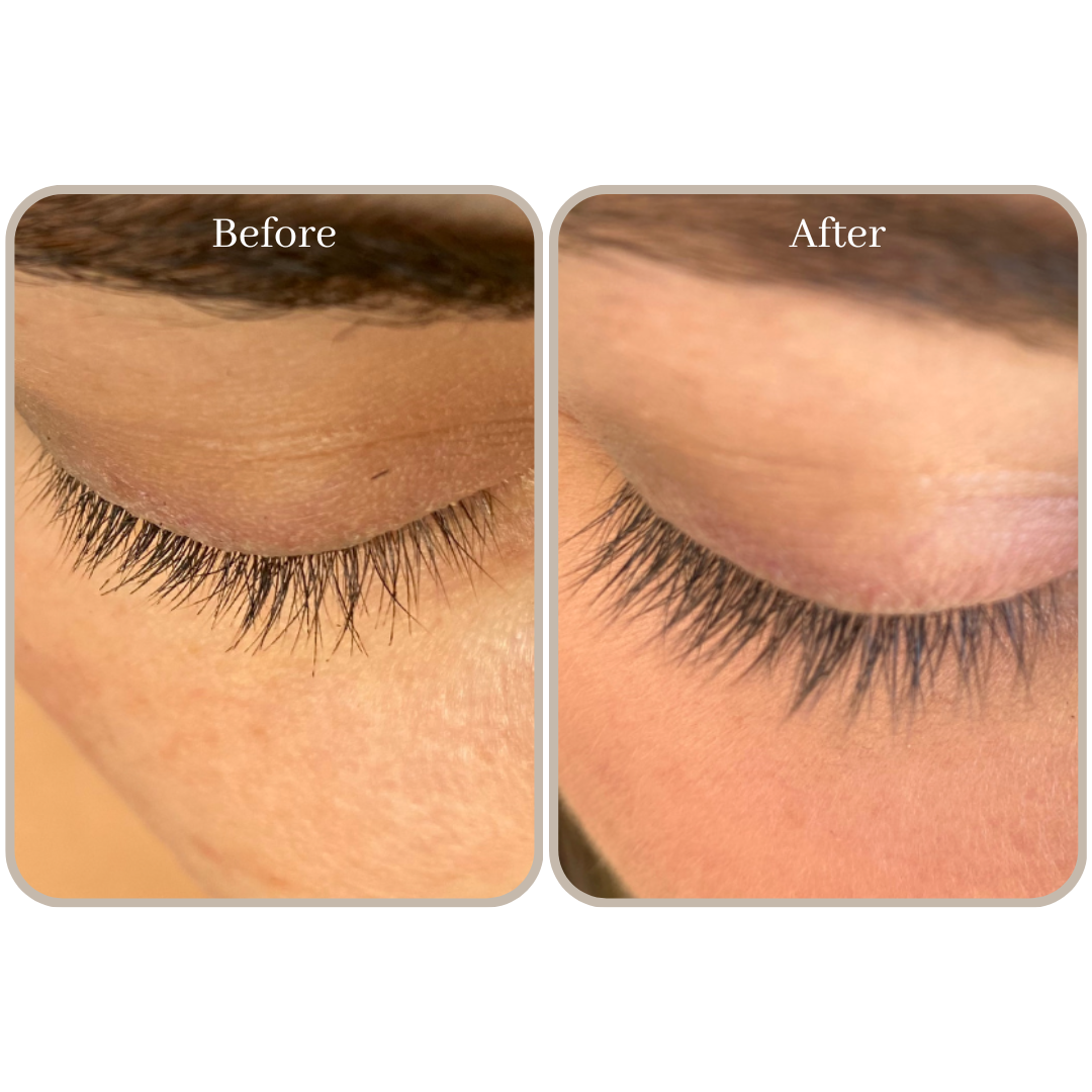 lash serum results lashgro australia
