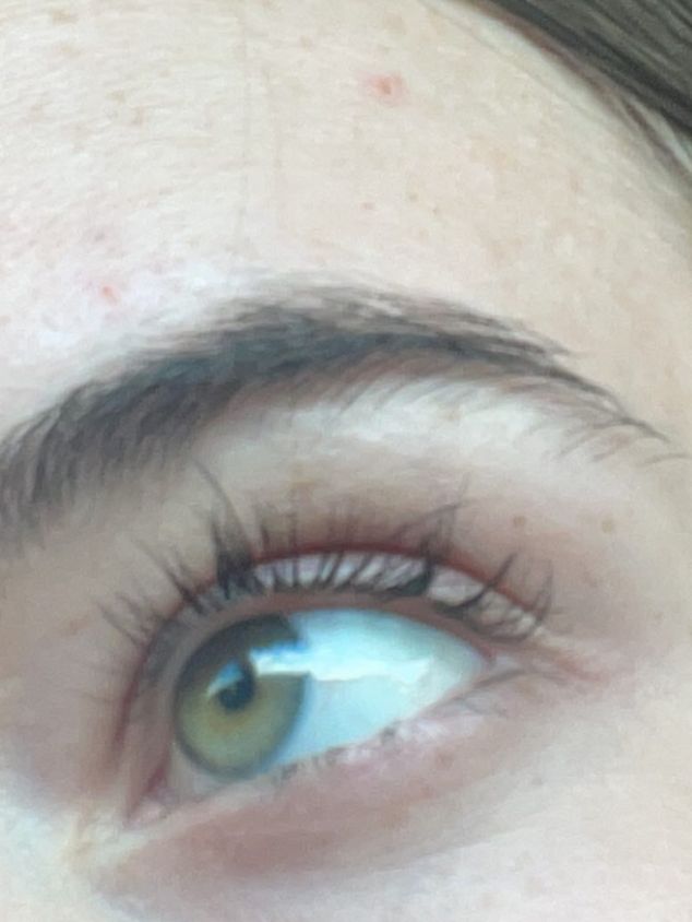lashgro after serum results