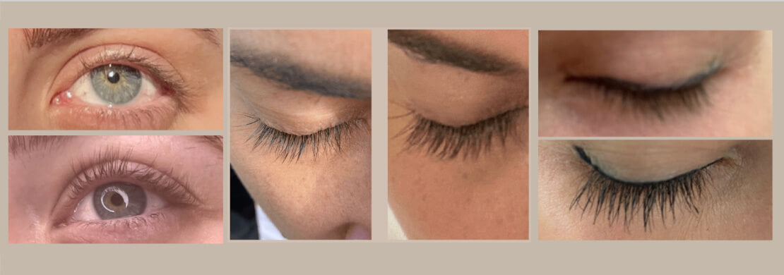 eyelash growth results