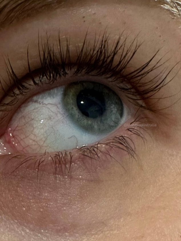 eyelash results lashgro australia